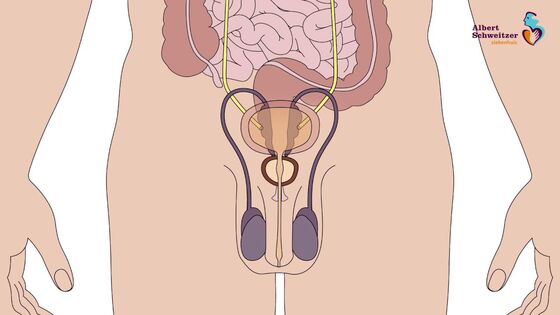 Prostaatverwijdering via robotchirurgie